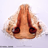 Phoneutria nigriventer, vulva (dissected) of female from South Brazil, dorsal view