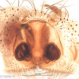 female epigyne, dorsal view