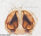 Ctenus villasboasi, female vulva dorsal view Photo: Hubert Höfer