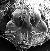 female epigyne (SEM)