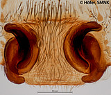 Ctenus maculisternis, female epigyne, ventral