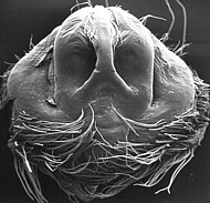 female epigyne (SEM)