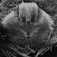 female epigyne (SEM)